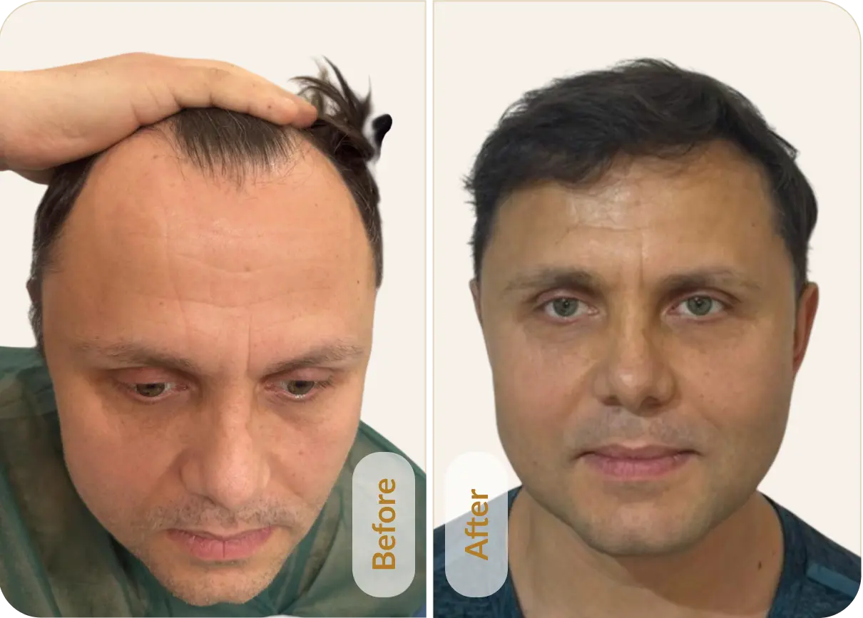 Risultato 1